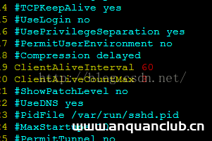 图片[2]-详解xshell远程连接自动断开的问题解决办法_Linux-渗透云记 - 专注于网络安全与技术分享